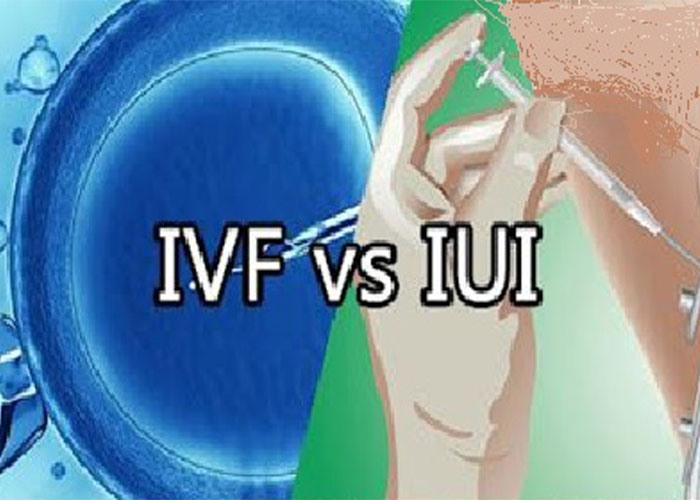 تفاوت IVF و IUI